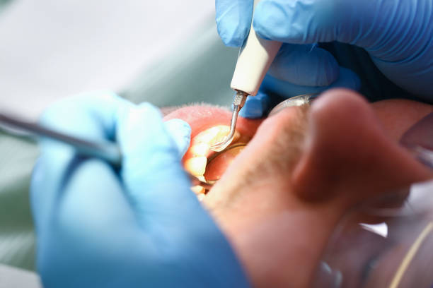 Best Emergency Orthodontic Repairs in West Burlington, IA