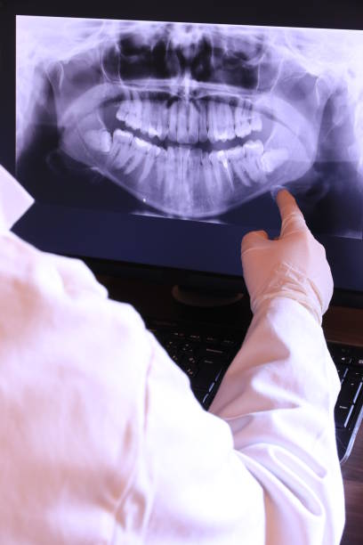 Best Dental Abscess Treatment in West Burlington, IA