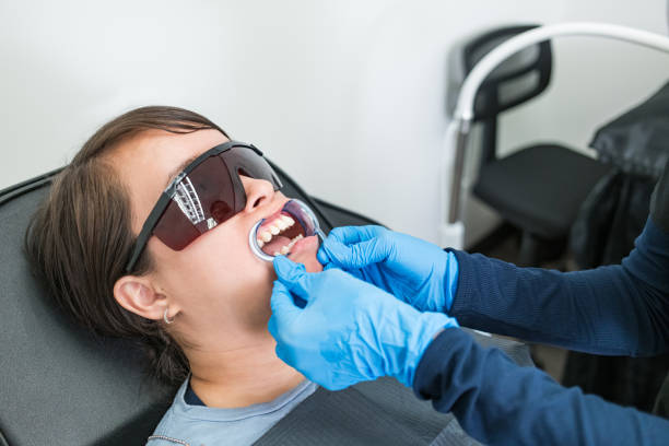 Best Emergency Wisdom Tooth Extraction in West Burlington, IA